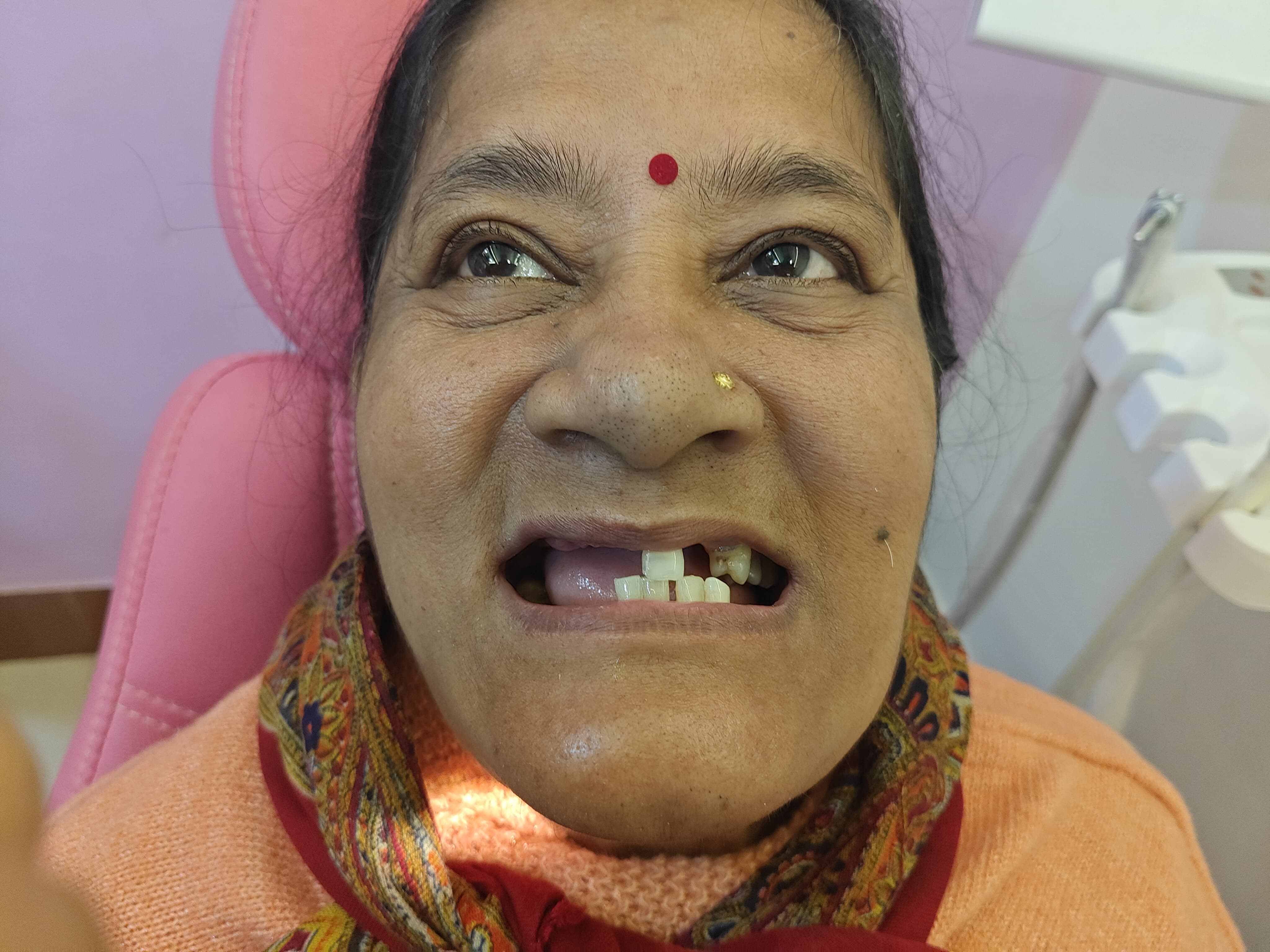 Smile Transformation Case 7